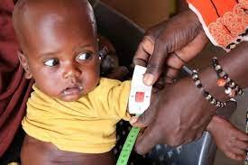 Management of Severe and Moderate Acute Malnutrition 